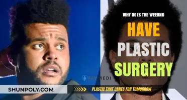 The Weeknd's Transformation: Unveiling the Reasons Behind His Plastic Surgery