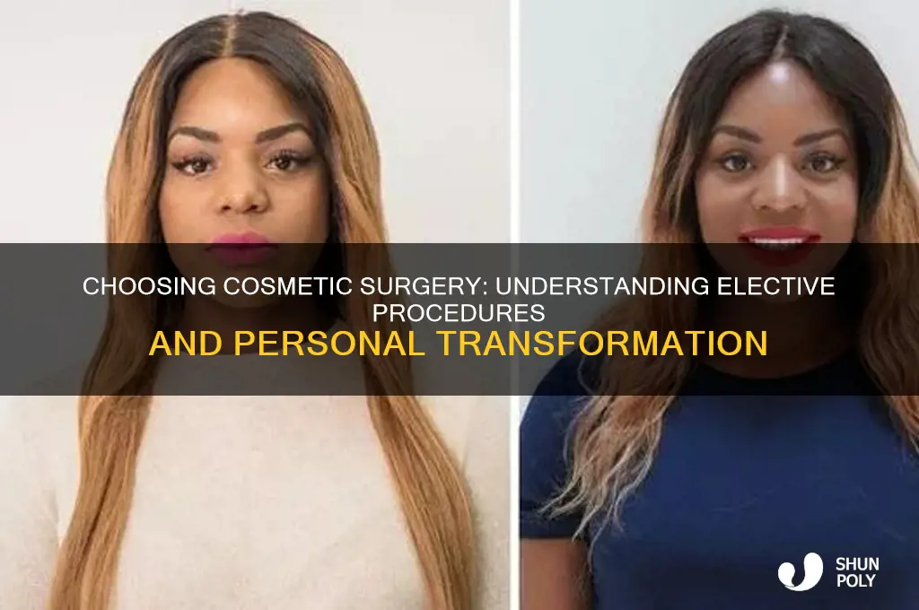 why elective what to have plastic surgery for cosmetiue