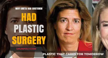 Greta Van Susteren's Plastic Surgery: Unveiling Her Transformation Journey
