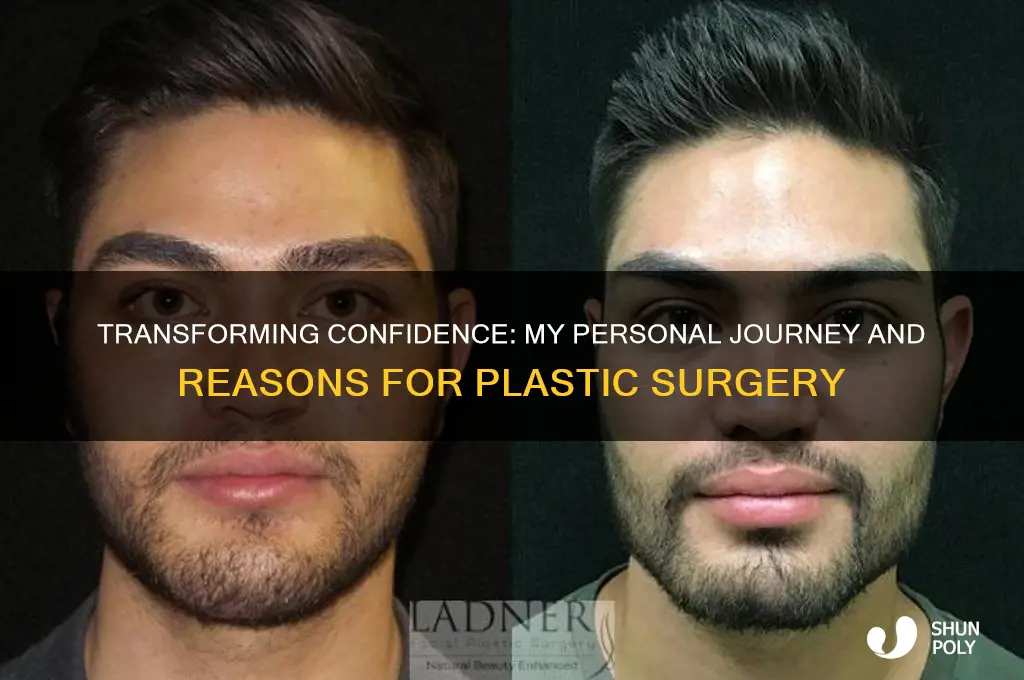 why i should get plastic surgery