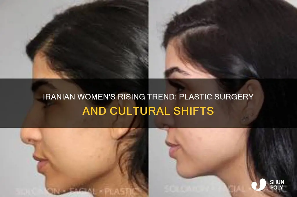 why iranian women are having plastic surgery