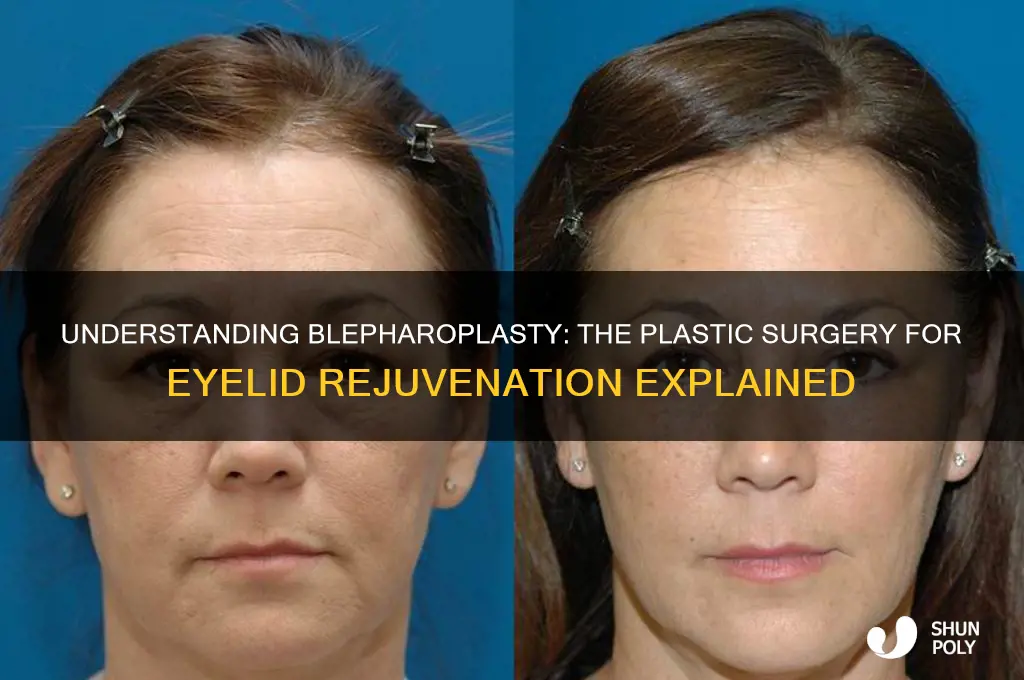 why is blepharoplasty called plastic surgery
