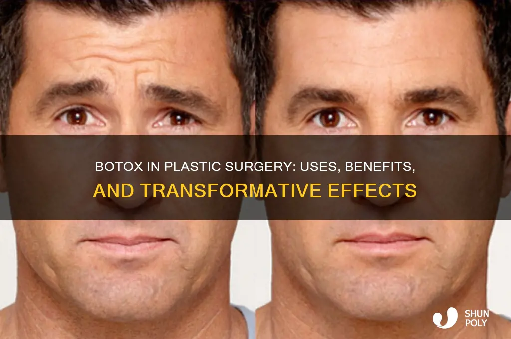 why is botox used in plastic surgery