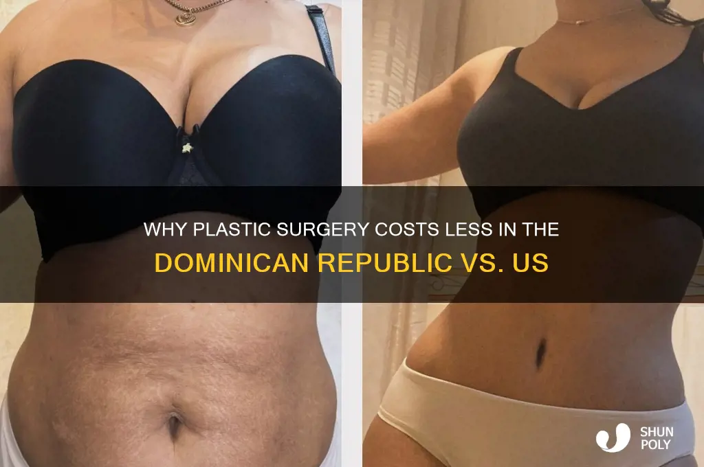 why is dr so much cheaper than us plastic surgery