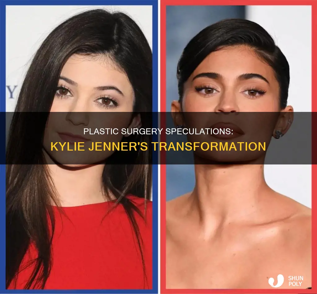 why is kylie jenner called plastic