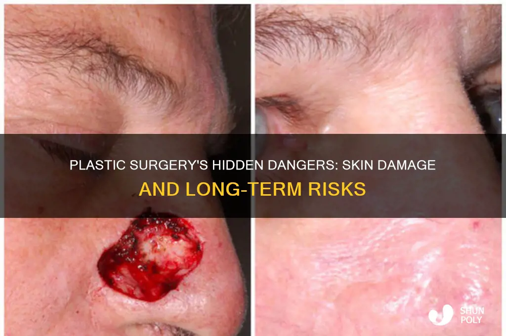 why is plastic surgery bad for your skin