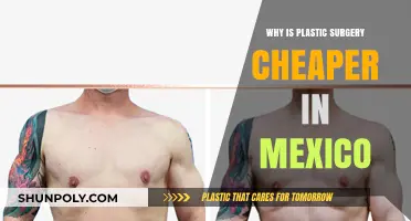 Why Plastic Surgery Costs Less in Mexico: A Comprehensive Guide
