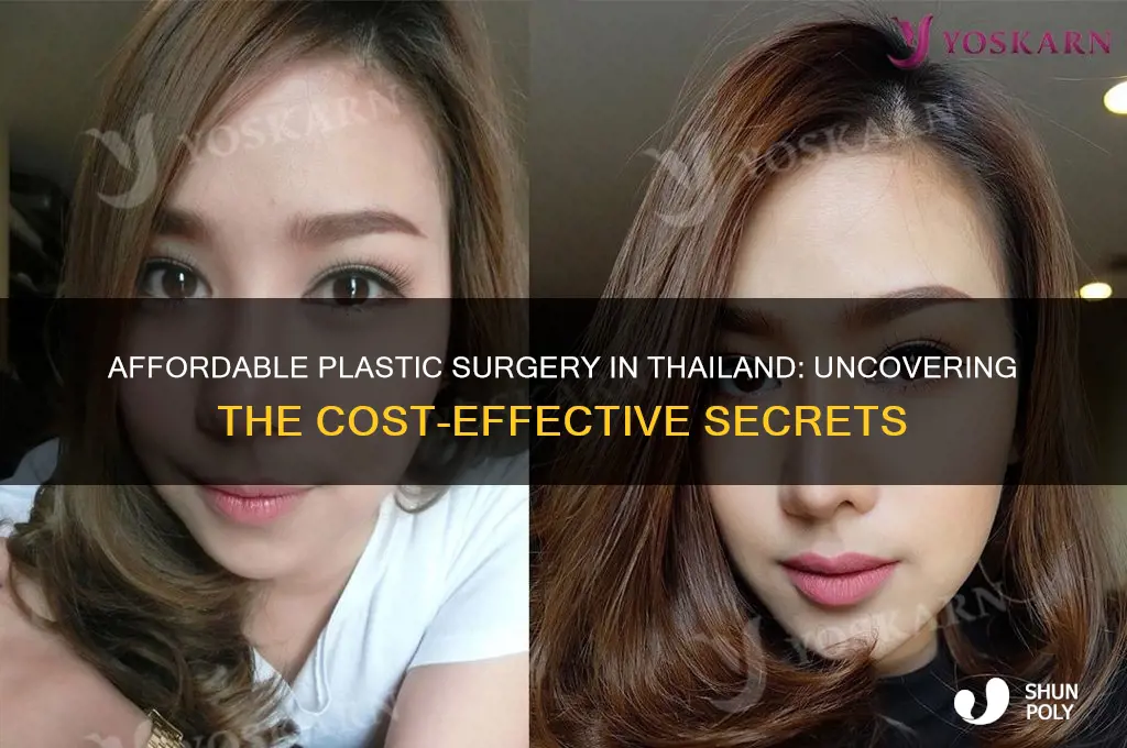 why is plastic surgery so cheap in thailand