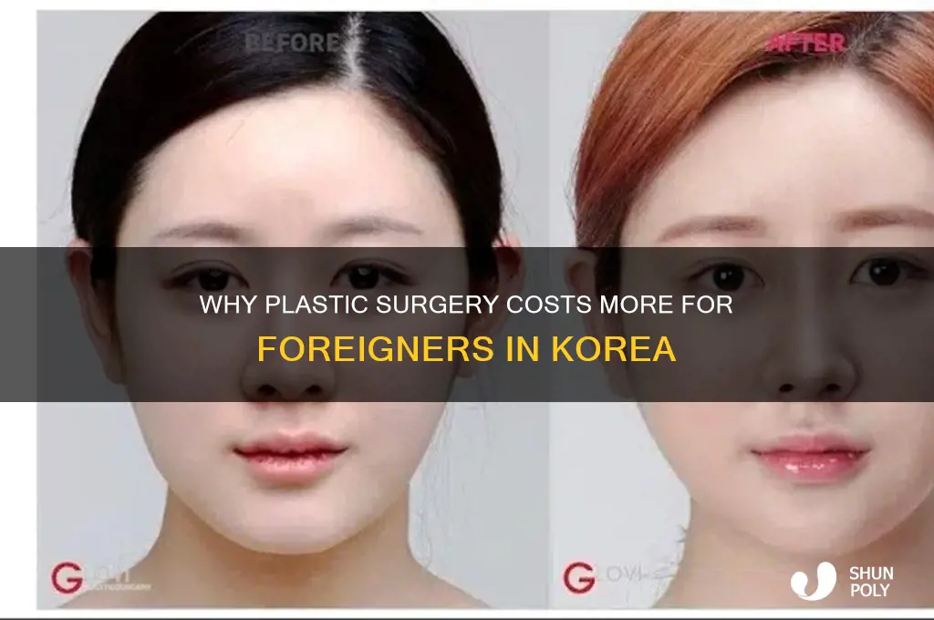 why is plastic surgery so expensive for foreigners in korea