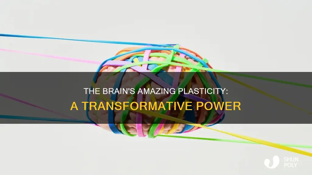 why is the brain considered plastic