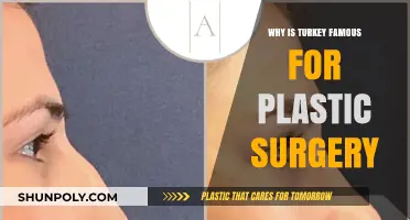 Turkey's Rise as a Global Hub for Affordable, High-Quality Plastic Surgery