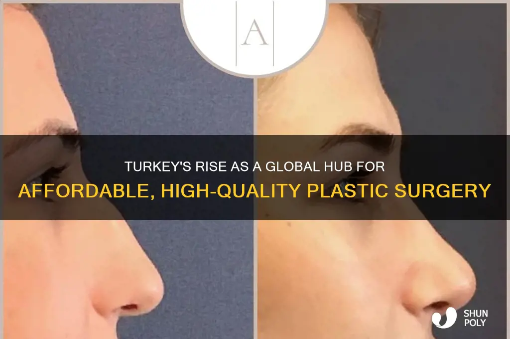 why is turkey famous for plastic surgery