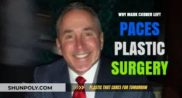 Why Mark Codner Left Paces Plastic Surgery: Uncovering the Reasons