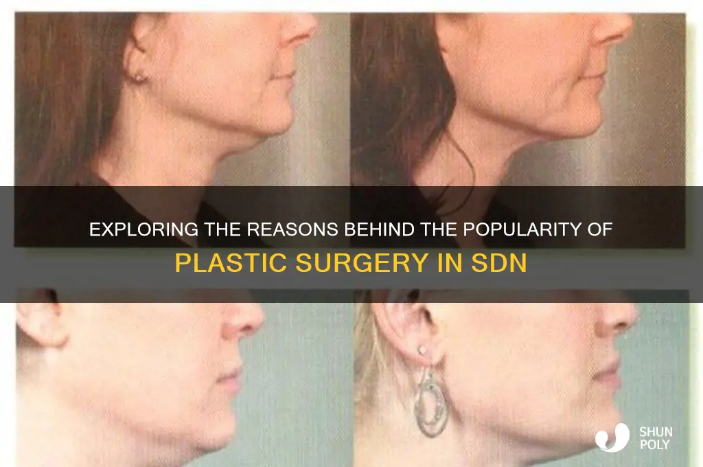 why plastic surgery sdn