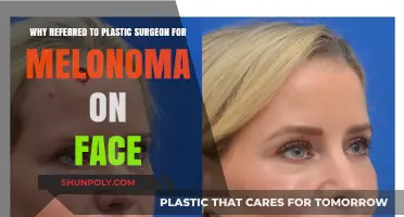Why Plastic Surgeons Are Key for Facial Melanoma Treatment