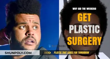 Why Did The Weeknd Undergo Plastic Surgery? Unveiling the Truth