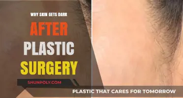 Post-Surgery Skin Darkening: Causes and Solutions for Hyperpigmentation
