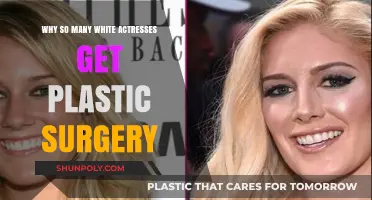 Why White Actresses Often Turn to Plastic Surgery: Unveiling the Pressure