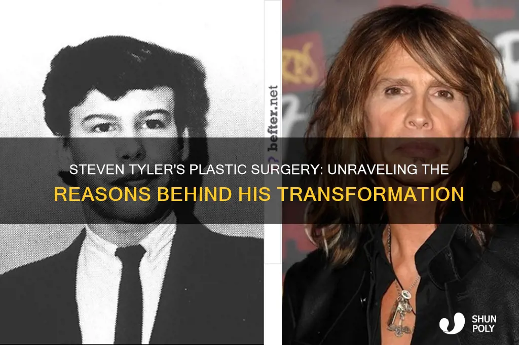 why steven tyler plastic surgery