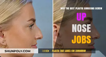 Why Even Top Plastic Surgeons Fail at Rhinoplasty: Unveiling the Risks