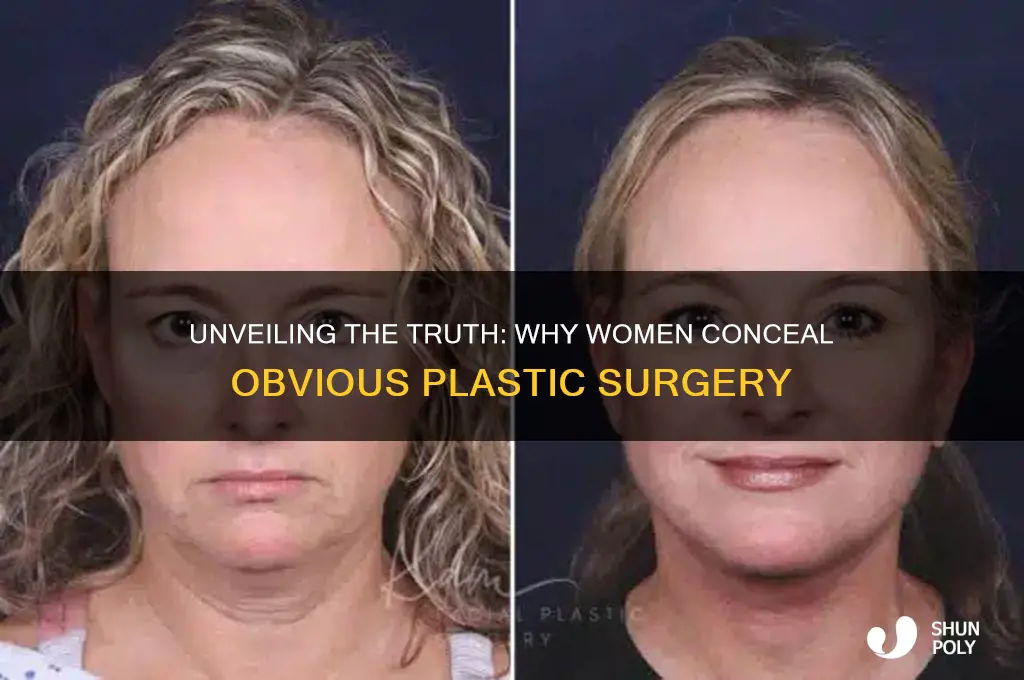 why women lie about obvious plastic surgery