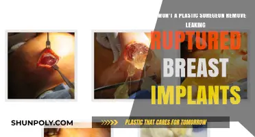 Leaking Ruptured Breast Implants: Why Plastic Surgeons Refuse Removal