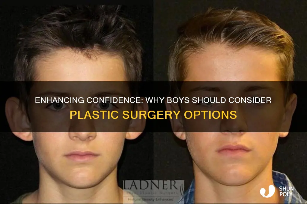 why you should plastic surgery boys