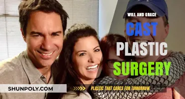 Will & Grace Cast: Plastic Surgery Rumors and Transformations