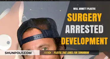 Will Arnett's Plastic Surgery: Unveiling the Truth Behind Arrested Development