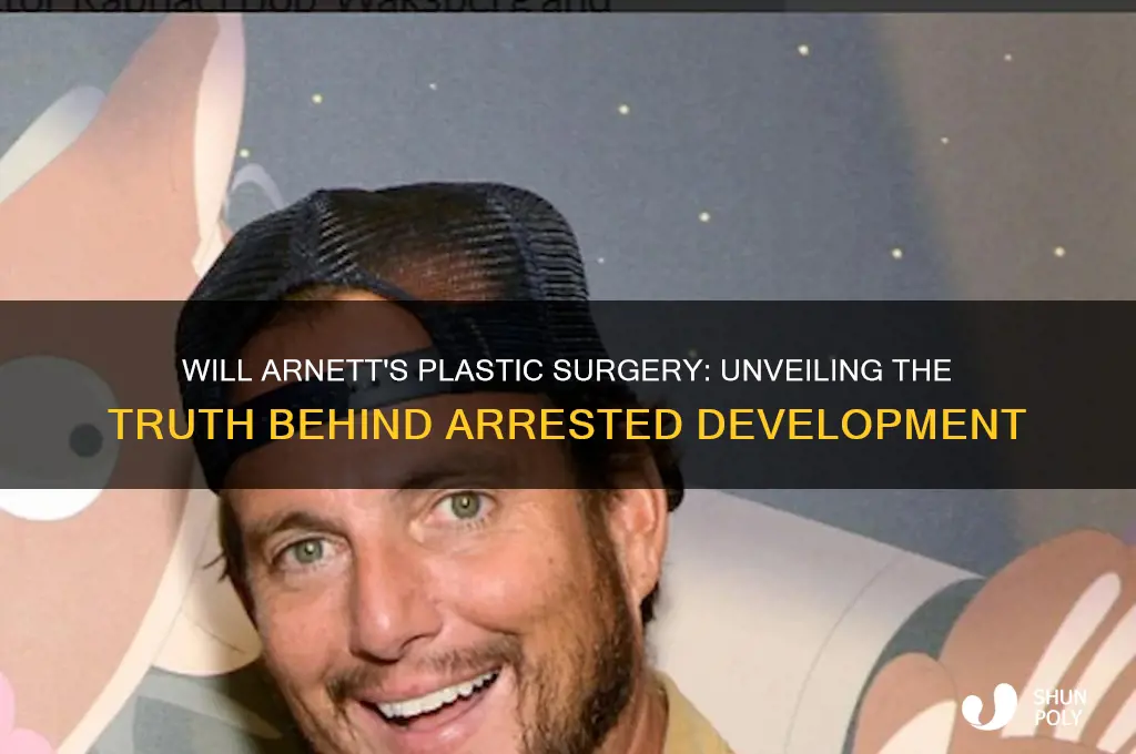 will arnett plastic surgery arrested development