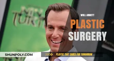 Will Arnett Plastic Surgery: Fact-Checking Rumors and Speculations