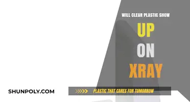 Does Clear Plastic Appear on X-Rays? Unveiling the Truth