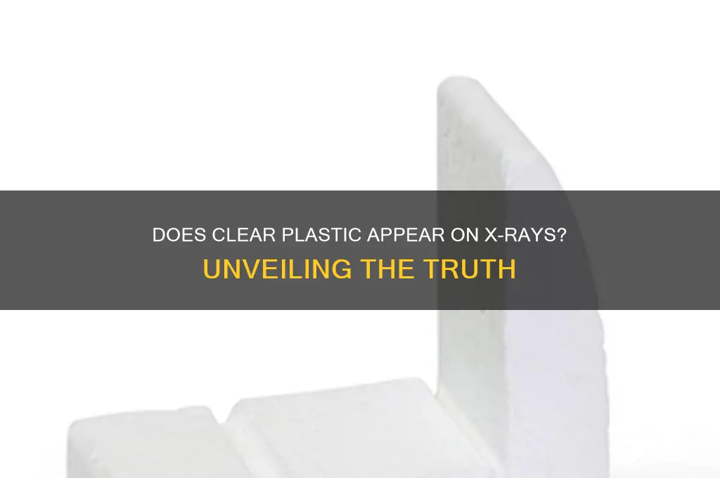 will clear plastic show up on xray