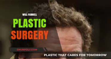 Will Ferrell's Plastic Surgery: Fact-Checking the Rumors and Speculations