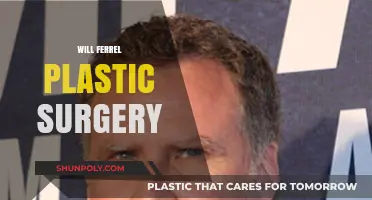 Will Ferrell Plastic Surgery: Fact-Checking Rumors and Speculations