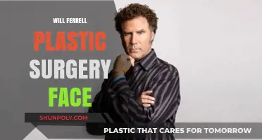 Will Ferrell's Face: Plastic Surgery Rumors and Speculations
