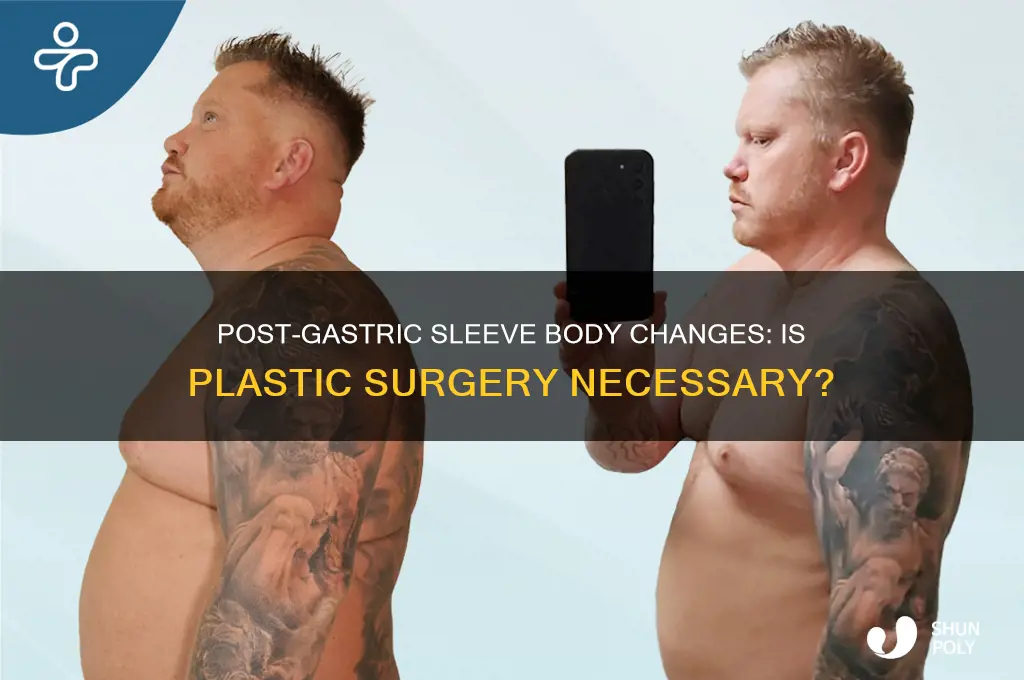 will i need plastic surgery after gastric sleeve