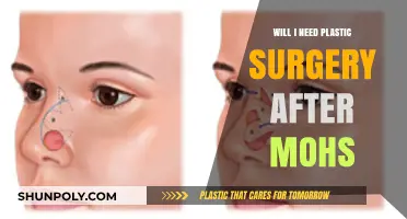 Post-Mohs Surgery: When Is Plastic Surgery Necessary for Skin Cancer?