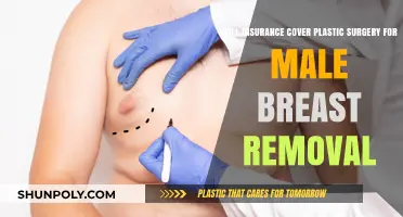 Does Insurance Cover Gynecomastia Surgery? Male Breast Removal Explained