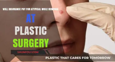 Does Insurance Cover Atypical Mole Removal in Plastic Surgery Procedures?