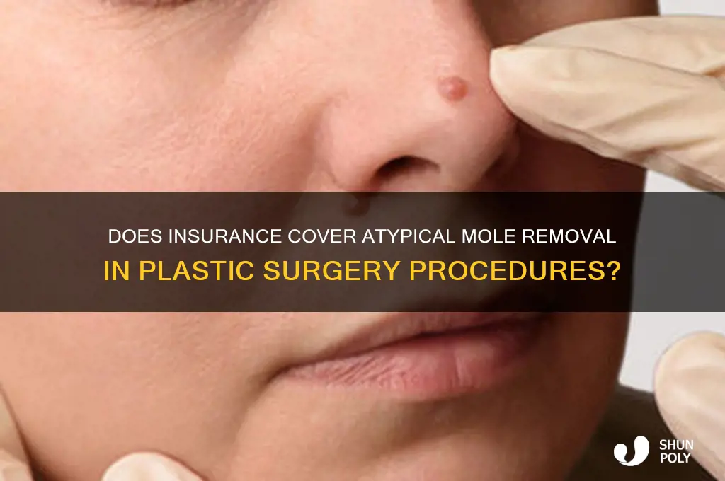 will insurance pay for atypical mole removal at plastic surgery