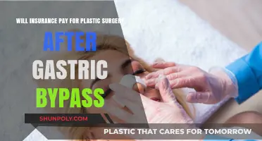 Does Insurance Cover Plastic Surgery Post-Gastric Bypass? Key Insights