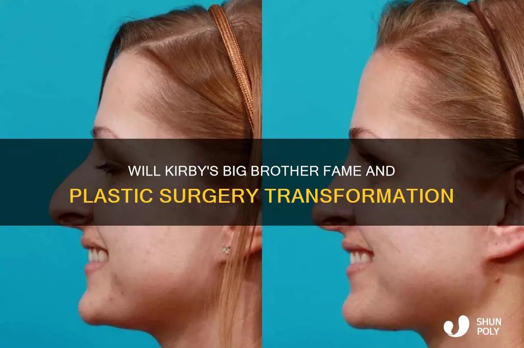 will kirby big brother plastic surgery