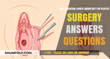 Does Medicaid Cover Labiaplasty or Plastic Surgery? Key Answers
