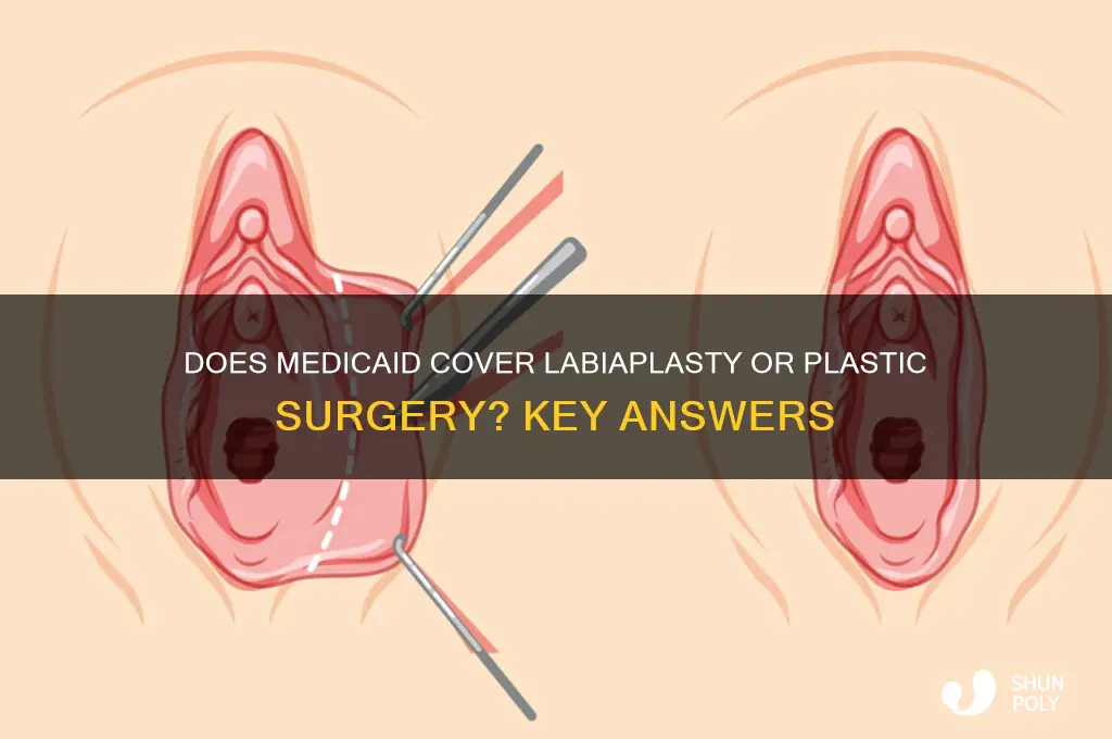 will medicaid cover labiaplasty or plastic surgery answers questions