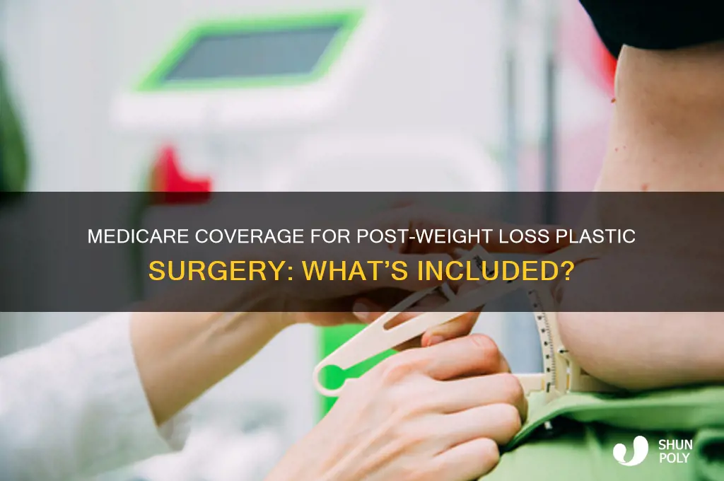 will medicare cover plastic surgery after weight loss