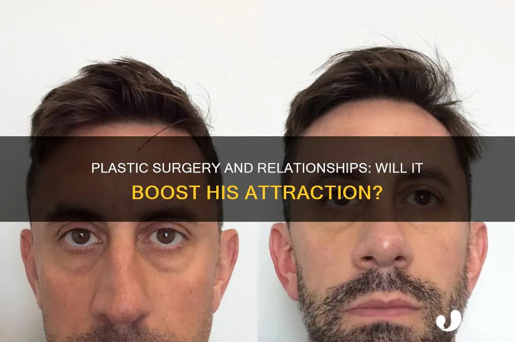 will my boyfriend come onto me more after plastic surgery