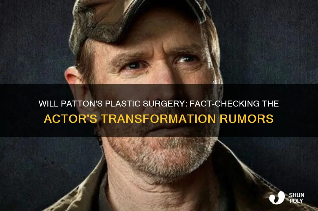 will patton plastic surgery