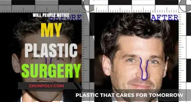 Will Anyone Notice My Plastic Surgery? Balancing Expectations and Reality