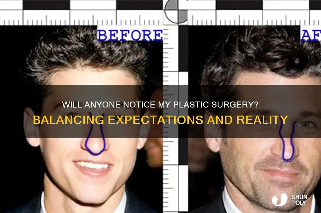 will people notice my plastic surgery